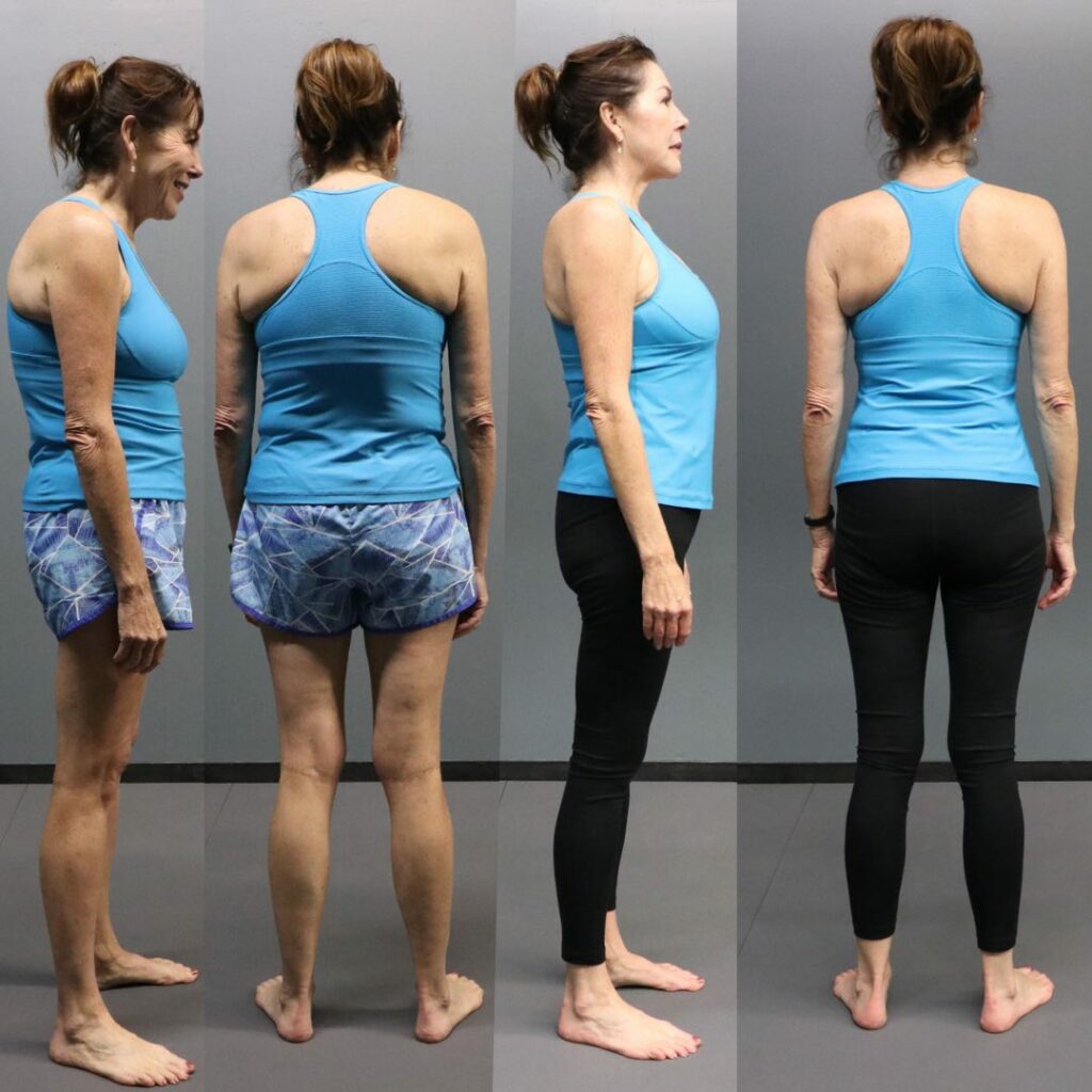 POSTURE CORRECTOR